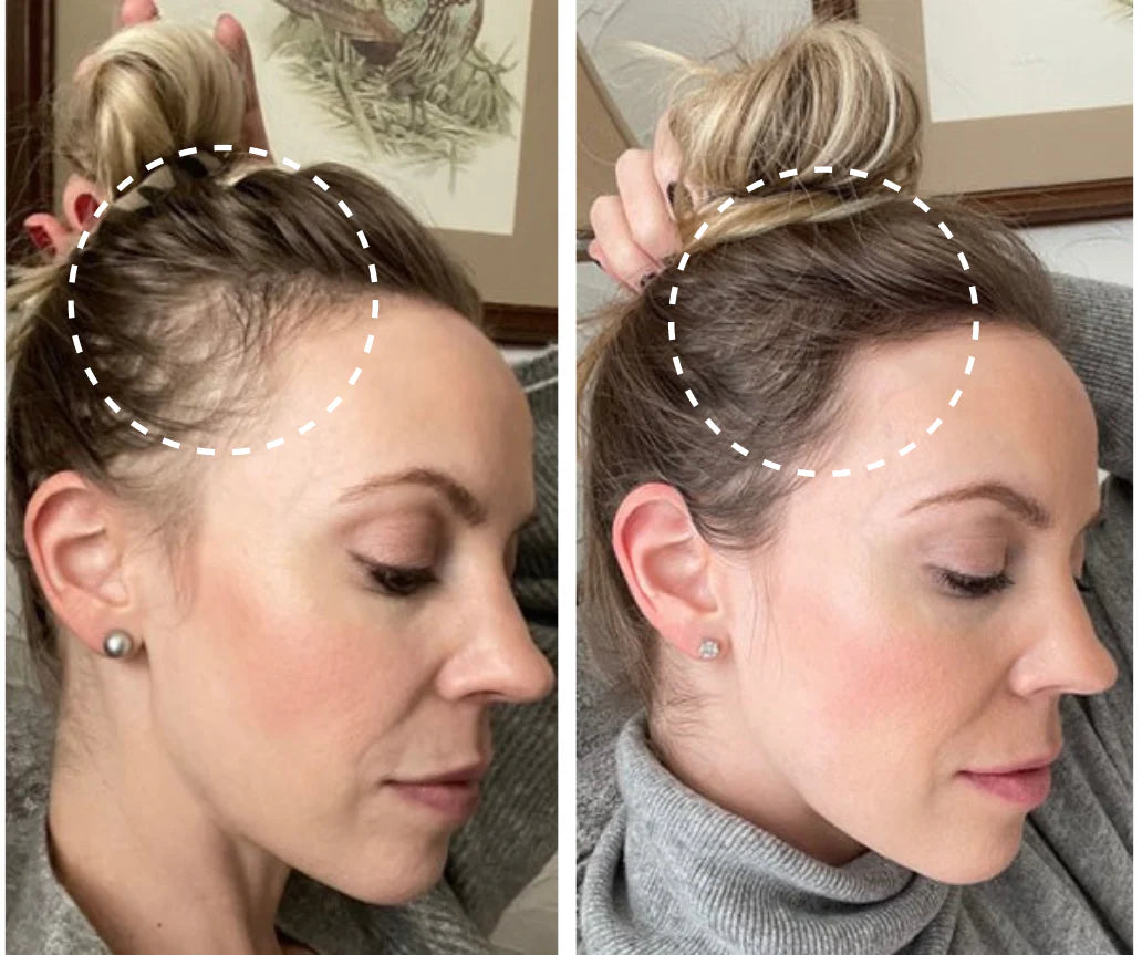 Scalp Massager